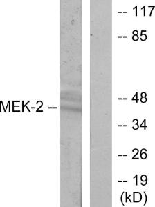 Western blot analysis of lysates from ovary cancer cells using Anti-MEK2 Antibody. The right hand lane represents a negative control, where the antibody is blocked by the immunising peptide.