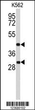 Anti-DFFA Rabbit Polyclonal Antibody