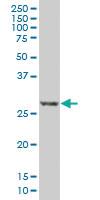 Anti-RCAN1 Mouse Monoclonal Antibody [clone: 1G7]