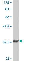 Anti-RNF122 Mouse Polyclonal Antibody