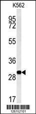 Anti-ELP6 Rabbit Polyclonal Antibody (APC (Allophycocyanin))