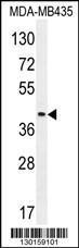 Anti-LILRA5 Rabbit Polyclonal Antibody (APC (Allophycocyanin))