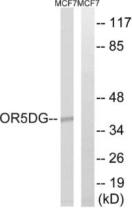 Anti-OR5D16 Rabbit Polyclonal Antibody