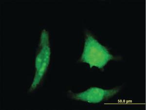 Anti-RCAN1 Mouse Monoclonal Antibody [clone: 1B1]