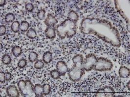 Anti-MEF2A Mouse Monoclonal Antibody [clone: 1D11]