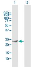 Anti-GINS1 Rabbit Polyclonal Antibody