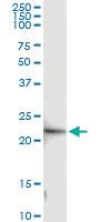 Anti-GINS1 Polyclonal Antibody Pair