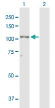 Anti-ZEB2 Rabbit Polyclonal Antibody