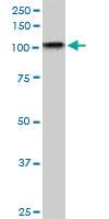 Anti-TAOK3 Mouse Monoclonal Antibody [clone: 1D2]