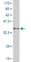 Anti-RNF122 Mouse Monoclonal Antibody [clone: 5E5]