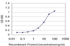 Anti-RCAN1 Mouse Monoclonal Antibody [clone: 1B1]