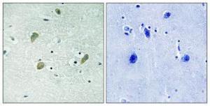 Antibody anti-CSNK1G1 100 µg