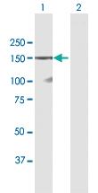 Anti-DSG1 Mouse Polyclonal Antibody