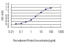 Anti-NEK9 Mouse Monoclonal Antibody [clone: 1F6]