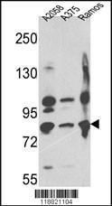 Anti-MME Rabbit Polyclonal Antibody (AP (Alkaline Phosphatase))