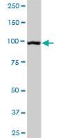 Anti-DSG1 Mouse Polyclonal Antibody