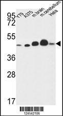 Anti-NDUFS2 Rabbit Polyclonal Antibody (AP (Alkaline Phosphatase))