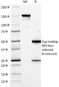 SDS-PAGE analysis of Anti-Elastin Antibody [ELN/2069] under non-reduced and reduced conditions; showing intact IgG and intact heavy and light chains, respectively. SDS-PAGE analysis confirms the integrity and purity of the antibody.