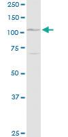 Anti-DSG1 Rabbit Polyclonal Antibody