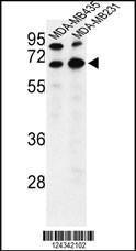 Anti-BEST2 Rabbit Polyclonal Antibody