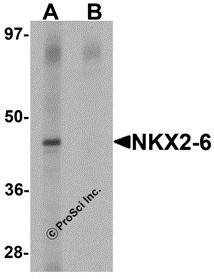 Western blot analysis of NKX2-6 in mouse spleen tissue lysate with NKX2-6 antibody at 1 &#956;g/mL in (A) the absence and (B) the presence of blocking peptide.