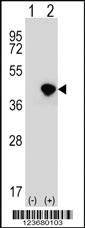 Anti-DFFA Rabbit Polyclonal Antibody