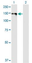 Anti-DSG1 Rabbit Polyclonal Antibody