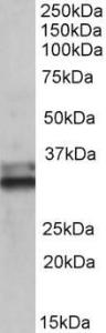 Anti-ETFA Antibody (A83013) (0.1 µg/ml) staining of Human Colon lysate (35 µg protein in RIPA buffer). Primary incubation was 1 hour. Detected by chemiluminescence