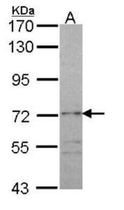 Anti-GPX3 Rabbit Polyclonal Antibody