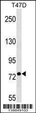 Anti-BEST3 Rabbit Polyclonal Antibody (AP (Alkaline Phosphatase))