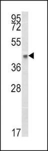 Anti-HLA Class 1 Antigen B Rabbit Polyclonal Antibody (HRP (Horseradish Peroxidase))