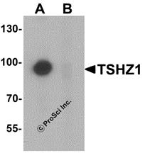 Western blot analysis of TSHZ1 in A-20 cell lysate with TSHZ1 antibody at 1 &#956;g/mL in (A) the absence and (B) the presence of blocking peptide.