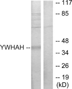 Western blot analysis of lysates from Jurkat cells using Anti-14-3-3 eta Antibody. The right hand lane represents a negative control, where the antibody is blocked by the immunising peptide.