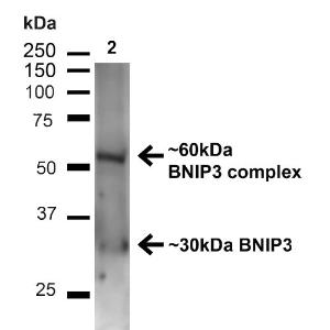 Western blot analysis of mouse kidney showing detection of ~30kDa BNIP3 protein using Anti-BNIP3 Antibody (A304942) at 1:1,000 for 1 hour at room temperature Lane 1: MW Ladder Lane 2: mouse kidney (20  µg) Load: 20  µg Block: 5% milk + TBST for 1 hour at room temperature