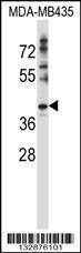 Anti-DNAJC28 Rabbit Polyclonal Antibody (PE (Phycoerythrin))