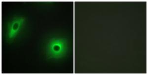 Immunofluorescence analysis of HeLa cells using Anti-14-3-3 eta Antibody. The right hand panel represents a negative control, where the antibody was pre-incubated with the immunising peptide.