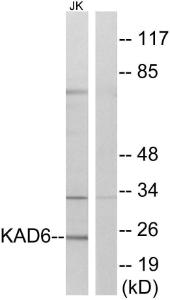 Western blot analysis of lysates from Jurkat cells using Anti-KAD6 Antibody The right hand lane represents a negative control, where the antibody is blocked by the immunising peptide