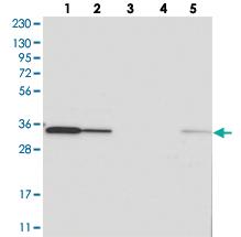 Anti-C1ORF74 Rabbit Polyclonal Antibody