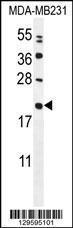 Anti-CHCHD4 Rabbit Polyclonal Antibody (HRP (Horseradish Peroxidase))