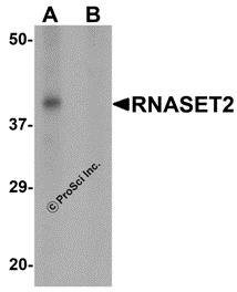 Western blot analysis of RNASET2 in SW480 cell lysate with RNASET2 antibody at 1 &#956;g/mL in (A) the absence and (B) the presence of blocking peptide.