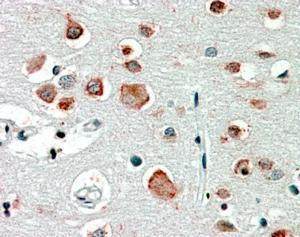 Anti-GABRA4 Antibody (A84624) (25 µg/ml) staining of paraffin embedded Human Cortex Steamed antigen retrieval with citrate buffer pH 6, AP-staining