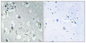 Immunohistochemical analysis of paraffin-embedded human brain using Anti-14-3-3 eta Antibody 1:100 (4°C overnight). The right hand panel represents a negative control, where the antibody was pre-incubated with the immunising peptide.