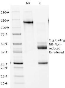 SDS-PAGE analysis of Anti-NKX2.2 Antibody [NX2/1524] under non-reduced and reduced conditions; showing intact IgG and intact heavy and light chains, respectively. SDS-PAGE analysis confirms the integrity and purity of the antibody.