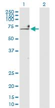 Anti-HNRNPK Rabbit Polyclonal Antibody