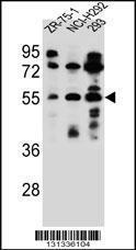 Anti-FUT6 Rabbit Polyclonal Antibody (AP (Alkaline Phosphatase))