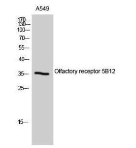 Western blot analysis of A549 cells using Anti-OR5B12 Antibody