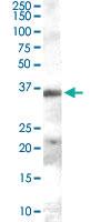 Anti-HAVCR2 Goat Polyclonal Antibody