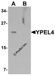 Western blot analysis of YPEL4 in SW480 cell lysate with YPEL4 antibody at 1 &#956;g/mL in (A) the absence and (B) the presence of blocking peptide.