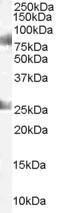 Anti-CDYL Antibody (A83015) staining (1 µg/ml) of Human Testes lysate (RIPA buffer, 35 µg total protein per lane). Primary incubated for 1 hour. Detected by western blot using chemiluminescence