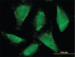 Anti-ACAA1 Mouse Polyclonal Antibody